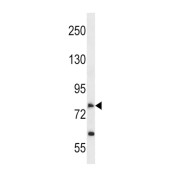 Solute Carrier Family 28 Member 2 (SLC28A2) Antibody