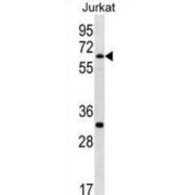 SWI/SNF Related, Matrix Associated, Actin Dependent Regulator of Chromatin, Subfamily D, Member 1 (SMARCD1) Antibody