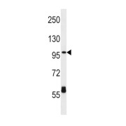 Carnitine O-Palmitoyltransferase 1, Brain Isoform (CPT1C) Antibody