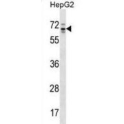 RP13-102H20.1 / ARHGAP36 Antibody