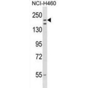 RING Finger Protein 160 (RNF160) Antibody