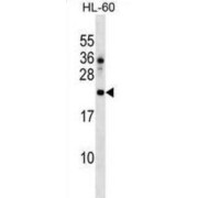 DnaJ Homolog Subfamily C Member 24 (DNAJC24) Antibody