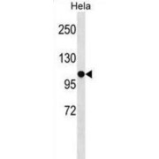 Splicing Factor SWAP Homolog (SFRS8) Antibody