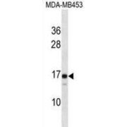 Lens Intrinsic Membrane Protein 2 (LIM2) Antibody