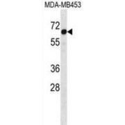 STEAP3 Metalloreductase (STEAP3) Antibody