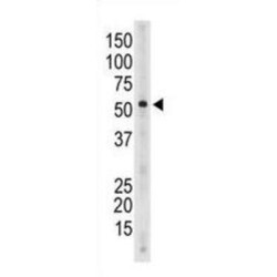 Sialic Acid Binding Ig Like Lectin 6 (SIGLEC6) Antibody