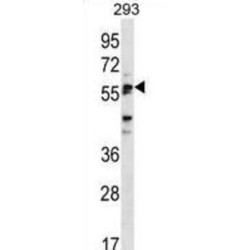 Sialic Acid Binding Ig Like Lectin 6 (SIGLEC6) Antibody