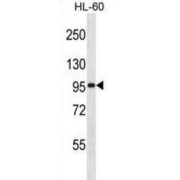 General Transcription Factor IIIC Subunit 2 (GTF3C2) Antibody