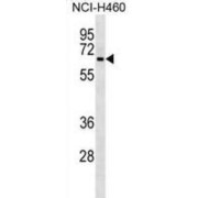 L-Dopachrome Tautomerase (DCT) Antibody