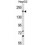 WB analysis of HepG2 cell line lysates (35 µg/lane), using PNPLA6 antibody for the detection of PNPLA6 protein.