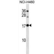 Ribosomal Protein L12 (RPL12) Antibody