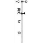 Molybdenum Cofactor Synthesis 2 (MOCS2) Antibody