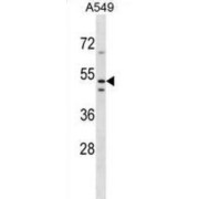 Transmembrane Protein 200A (TMEM200A) Antibody