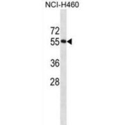 RNA Binding Motif Protein 45 (RBM45) Antibody