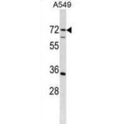 Cytidine And DCMP Deaminase Domain-Containing Protein 1 (CDADC1) Antibody