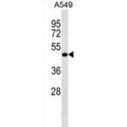 Leucine-Rich Repeat-Containing Protein 26 (LRRC26) Antibody