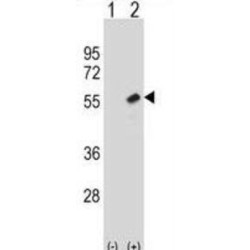 Histone-Binding Protein RBBP7 (RBBP7) Antibody