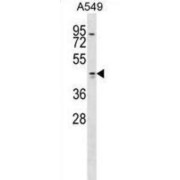 Tropomodulin-1 (TMOD1) Antibody