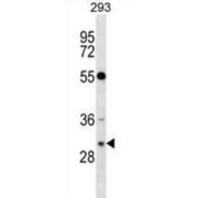 GTP-Binding Protein Rhes (RASD2) Antibody