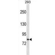 Solute Carrier Family 39, Member 6 (SLC39A6) Antibody