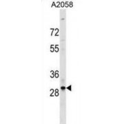 Olfactory Receptor 4F17 (OR4F17) Antibody
