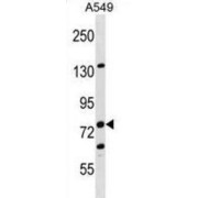 LIM Domain And Actin-Binding Protein 1 (LIMA1) Antibody