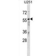 Ran-Binding Protein 3 (RANBP3) Antibody