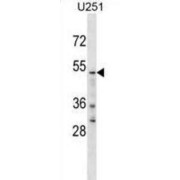 YTH Domain-Containing Family Protein 2 (YTHD2) Antibody