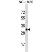 Olfactory Receptor 4D2 (OR4D2) Antibody