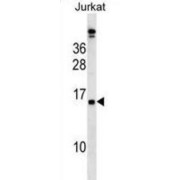 Placenta-Specific Protein 4 (PLAC4) Antibody