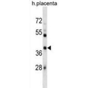 E3 Ubiquitin-Protein Ligase SIAH1 (SIAH1) Antibody