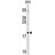 Ribosomal Protein L26 (RPL26) Antibody