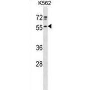 Cysteine Desulfurase, Mitochondrial (NFS1) Antibody