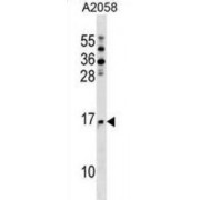 N-Acetyltransferase 5 (NAA20) Antibody