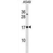 Translocon-Associated Protein Subunit Delta (SSR4) Antibody