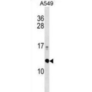 Enhancer of Rudimentary Homolog (Drosophila) (ERH) Antibody