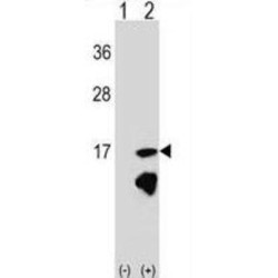 Enhancer of Rudimentary Homolog (Drosophila) (ERH) Antibody