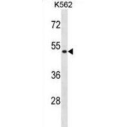 Enolase Superfamily Member 1 (ENOSF1) Antibody