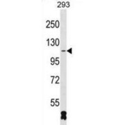 RNA Binding Motif Protein 26 (RBM26) Antibody