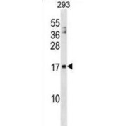 WB analysis of 293 cell line lysates (35 µg/lane), using MANF Antibody.