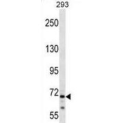 Centrosomal Protein 72 kDa (CEP72) Antibody