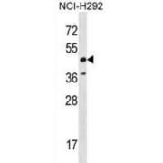 RAD52 Homolog, DNA Repair Protein (RAD52) Antibody