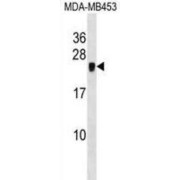 Cysteine-Rich Protein 2 (CRIP2) Antibody