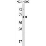 Cytohesin 4 (CYTH4) Antibody