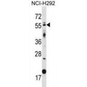 Zinc Finger Protein GLIS2 (GLIS2) Antibody