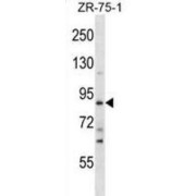 SLIT And NTRK Like Family Member 4 (SLITRK4) Antibody