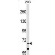 Zinc Finger Protein 214 (ZNF214) Antibody