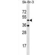 Ethanolamine Kinase 2 (ETNK2) Antibody