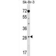 Steroidogenic Acute Regulatory Protein, Mitochondrial (STAR) Antibody