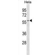 Ancient Ubiquitous Protein 1 (AUP1) Antibody